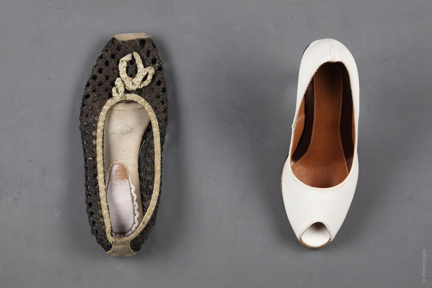 sisäänkasvaneet varpaankynnet vaatii mukavat kengät