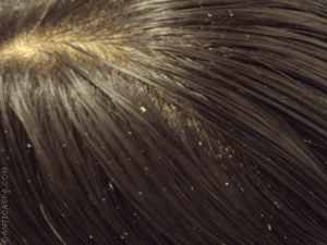 Luontaishoitoja hilsettä vastaan