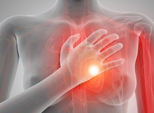 Tuleeko äkillinen sydämenpysähdys todella ilman varoitusta?