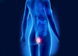 Peräpukamat - huomaa ja hoida ne ajoissa