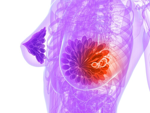 Pellavansiemenellä on rintasyöpää ehkäiseviä vaikutuksia.