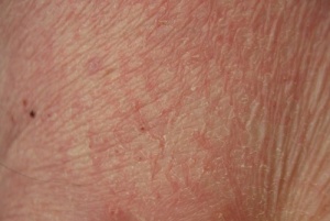 Sinun ihosi ja terveytesi