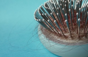 Estä hiustenlähtö luonnollisilla keinoilla