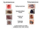 Kaikki Mitä Sinun Tulee Tietää Luomista - Askel Terveyteen