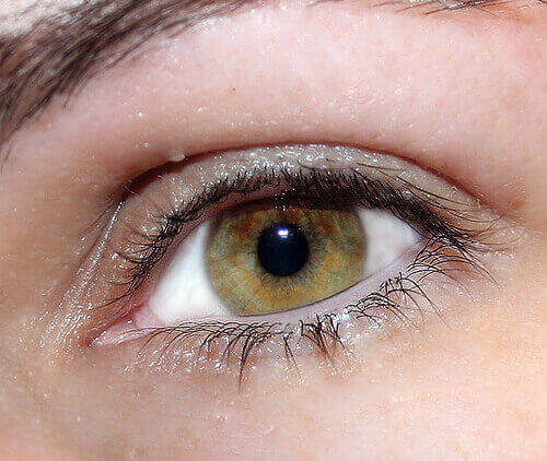 Silmien väri voi olla yhteydessä erilaisiin sairauksiin.
