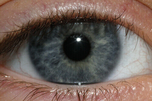 Silmien väri voi kertoa terveydestäsi paljonkin.
