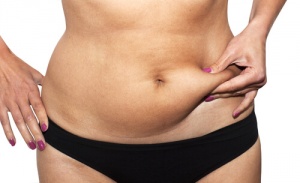 8 vinkkiä, joilla vähennät vatsarasvaa