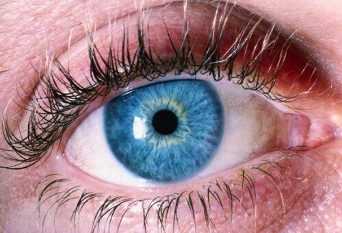 Alzheimerin taudin voi havaita silmistä