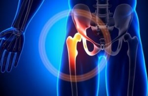 Mitä tehdä kalsiumin puutteelle