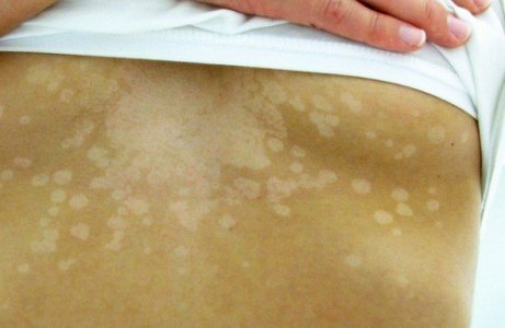 5 tapaa joilla ihosi kertoo sinulle että jokin on pielessä