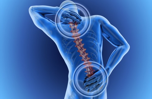 välilevypullistuma aiheuttaa selkäkipua