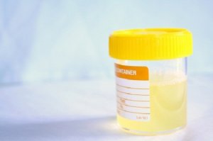Estä ja hoida virtsatietulehduksia luonnollisesti