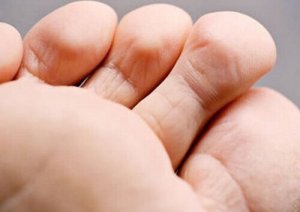 Näin estät jalkojen pahan hajun!