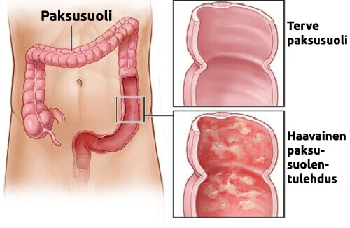suoli2