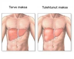 Onko maksasi tulehtunut?