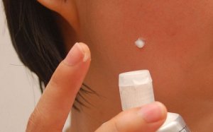 5 kotihoitoa, joita kannattaa välttää