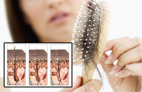 Hiustenlähtö naisilla – mistä se johtuu?