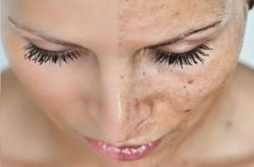 juo lämmintä vettä ehkäistäksesi ihon vanhentuminen