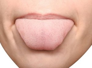 Mitä kieli kertoo terveydestä ja tunteista?