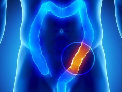 pellavansiemenet sopivat paksusuolen puhdistamiseen