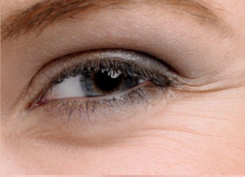 5 kotihoitokeinoa saadaksesi kauniin silmänympärysihon
