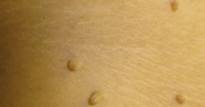 10 luonnollista tapaa syylien poistoon