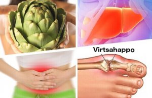 7 lääkinnällistä käyttötapaa artisokalle