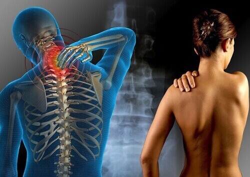 Hoida fibromyalgiaa näillä yrteillä