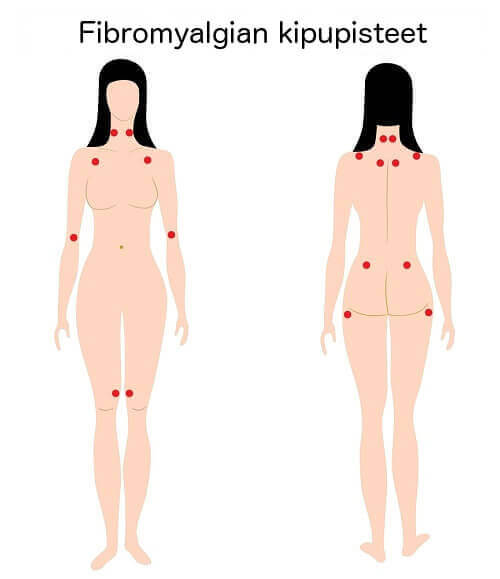 Some figure