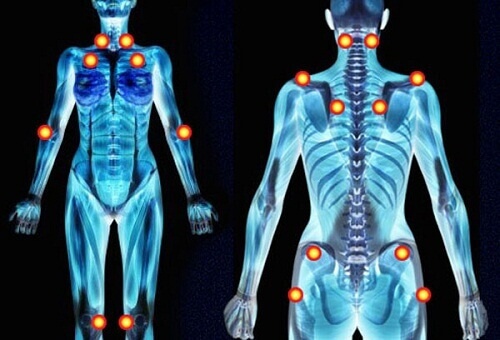 fibro1