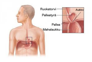 Voiko palleatyrää hoitaa?
