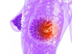 Rintasyövän diagnosointi pillerin avulla - mistä on kyse?