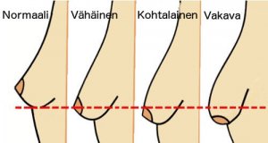 Nämä asiat vaikuttavat rintojen veltostumiseen