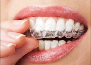 4 tapaa hoitaa bruksismi, eli hampaiden narskuttelu