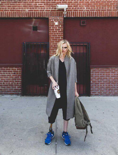 Lauren Wasserin jalka jouduttiin amputoimaan toksisen sokkioireyhtymän aiheuttaman kuolion vuoksi.