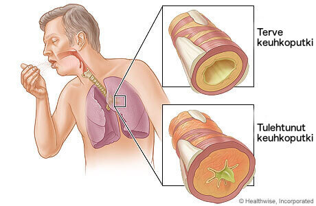 Toimivat ja terveet keuhkoputket ovat tärkeät ihmisen terveyden kannalta.