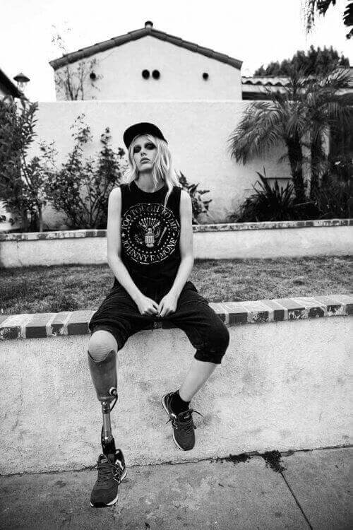 Lauren Wasser haluaa jakaa tietoisuutta toksisesta sokkioireyhtymästä.