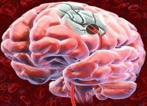 5 tapaa lisätä aivojen verenkiertoa