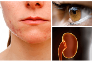 Mitkä elimet kärsivät eniten stressistä?