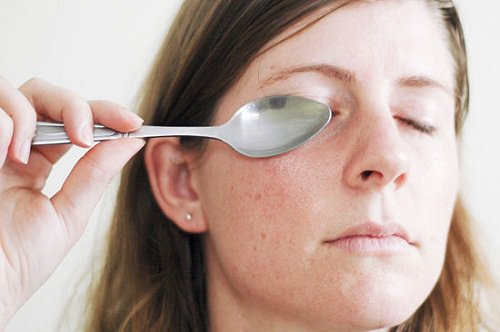 Lusikka silmällä auttaa laskemaan silmän turvotusta.