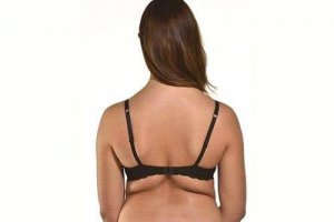 Poista selän jenkkakahvat