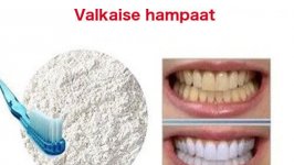 Hampaiden valkaisu