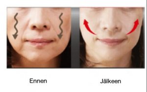 4 vinkkiä roikkuvien poskien kiinteyttämiseksi