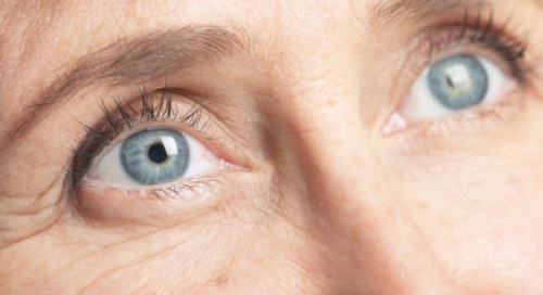 huonot elintavat aiheuttavat ryppyjä