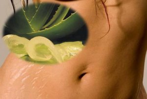 6 luonnollista hoitoa raskausarpiin