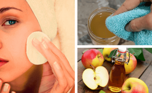Omenaviinietikkaa kasvojen puhdistukseen
