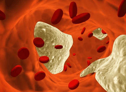 kolesteroli veressä