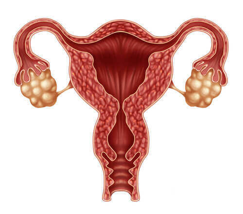 verenvuoto kuukautisten välillä voi johtua ovulaatiosta