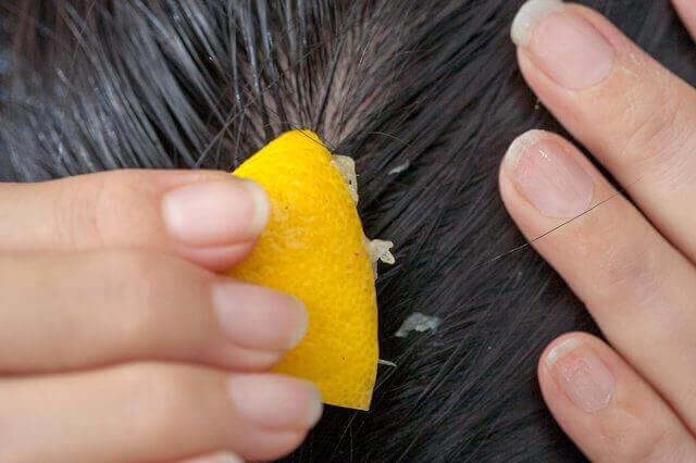 Ehkäise hiustenlähtöä sitruunamehulla