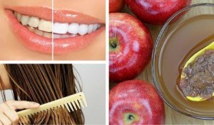 8 käyttöä omenaviinietikalle kauneudenhoidossa